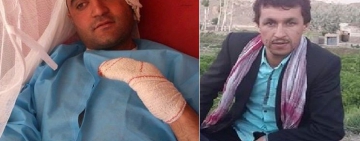 حمله به مجری تلویزیون ساقی در هرات و لت و کوب یک خبرنگار محلی را در غزنی محکوم می کنیم
